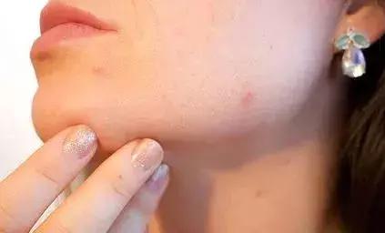 杭州十大皮肤科医院2025年排行榜前十名榜单出炉 杭州十大皮肤科医院2025年排行榜前十名榜单出炉